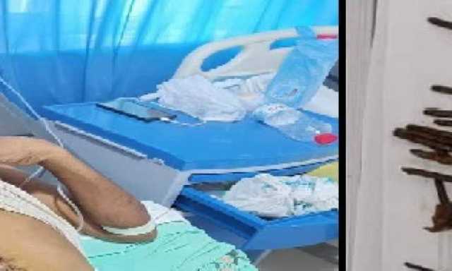في ظاهرة نادرة استخراج ١١٥ مسمار من معدة شاب في لحج