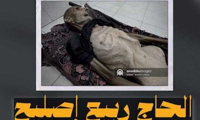 صورة مؤلمة من غزة