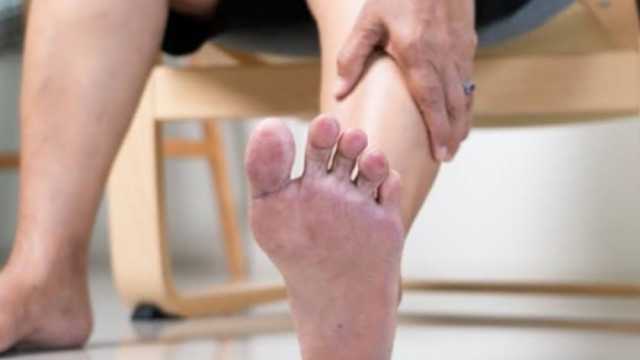 لمرضى السكري.. 10 نصائح من صحة «الشرقية» للحفاظ على سلامة القدمين