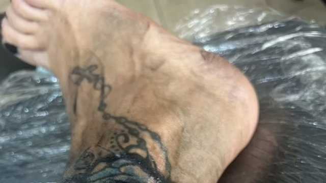 بريطانية تواجه خطر بتر قدمها بسبب الوشم.. 4 ساعات من الألم