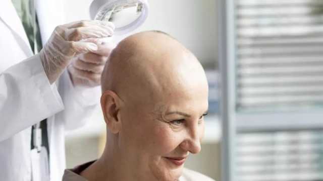 اكتشاف دواء جديد للوقاية من تساقط الشعر أثناء علاج السرطان.. ما علاقة الماعز؟