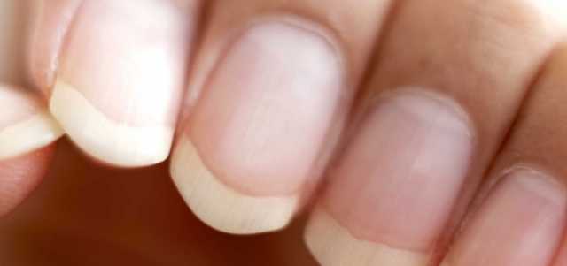 «لو عاوزة تخليهم بيلمعوا».. أسرع طريقة لتنظيف الأظافر في المنزل