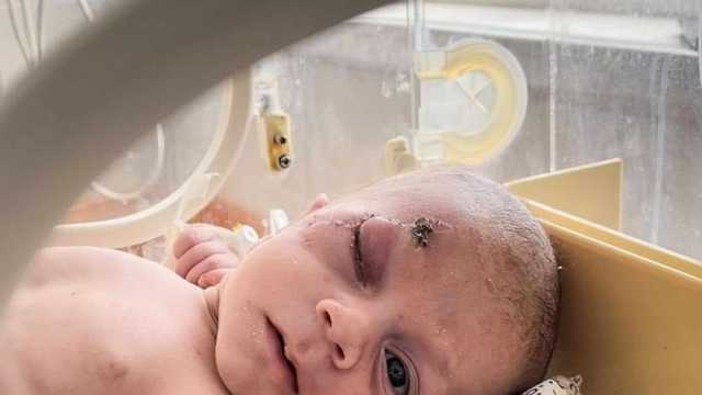 رضيعة فلسطينية طالب الآلاف بتبنيها.. ماذا كُتب في ملفها الطبي؟