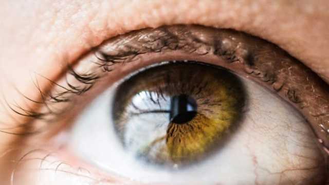 نحلة تلدغ رجل أمريكي في مقلة عينه.. ماذا حدث لنظره؟