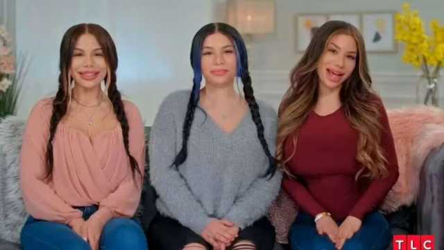 قصة أغرب 3 توائم في العالم.. يعيشون حياة واحدة
