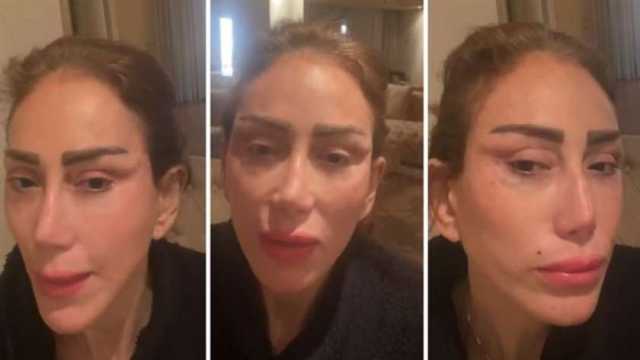 ريهام سعيد تنشر مقطع فيديو جديد خلال عملية تجميل: «أنا اتشوهت»