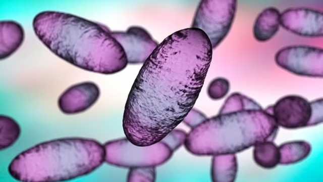 الطاعون الدبلي يثير القلق في ولاية أمريكية.. انتقل من قطة لمواطن