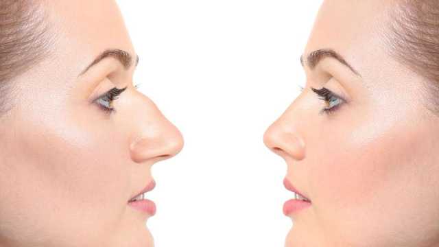 دار الإفتاء توضح حكم إجراء عمليات لتجميل الأنف: جائز بشرط واحد (فيديو)