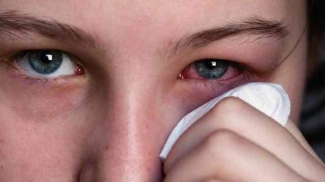 حساسية الربيع عند الأطفال.. الأعراض والأسباب