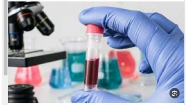 رئيس الجمعية المصرية لمنظار عنق الرحم: رحلة الـ«1000 كيلو» ستنطلق في الصعيد