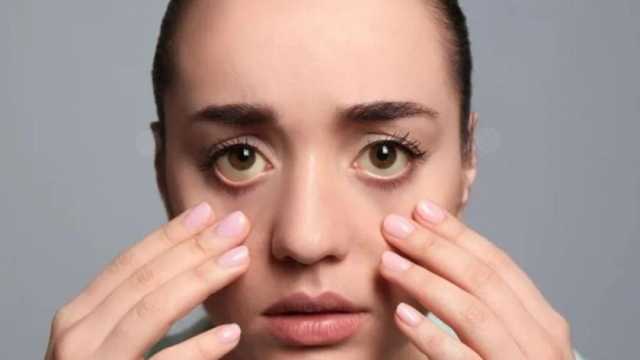 لون في العين يكشف عن إصابتك بأمراض خطيرة.. اذهب للطبيب فورا