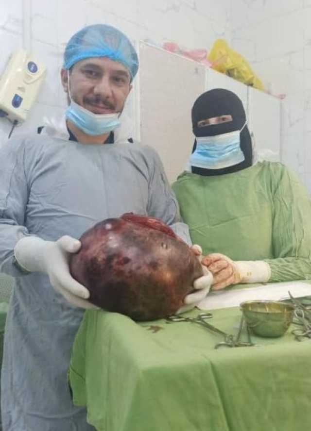استئصال كتلة كبيرة من بطن ثلاثينية يمنية
