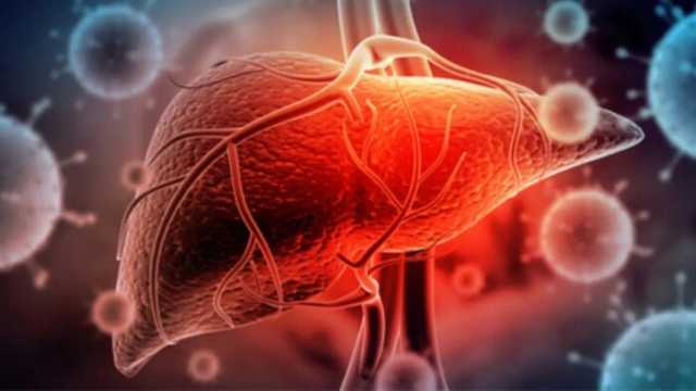 أسباب وأعراض تليف الكبد وطرق العلاج