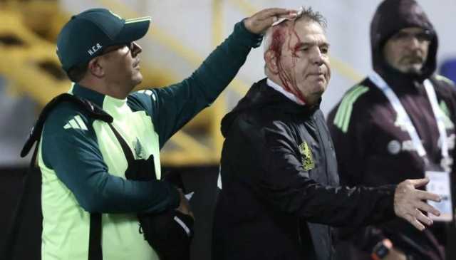 اتحاد كونكاكاف يعاقب هندوراس بسبب الإصابة الدامية لخافيير أجيري