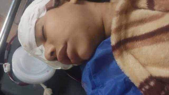 إصابة طفلة من ذوي الهمم بالمنوفية أثناء استقلالها قطار منوف