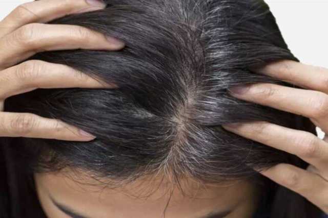 نقصها يصيبك بالشيب المبكر.. نصائح مهمة للحفاظ على شعرك