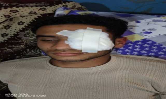 شاب يفقد بصره على يد آخر بسبب مشادة لفظية في عزبة الفار بطنطا