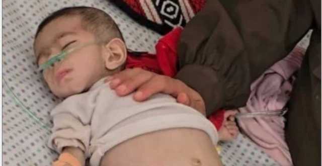 سلاح التجويع.. وفاة طفلة من غزة بسبب المجاعة والعدد يرتفع لـ54