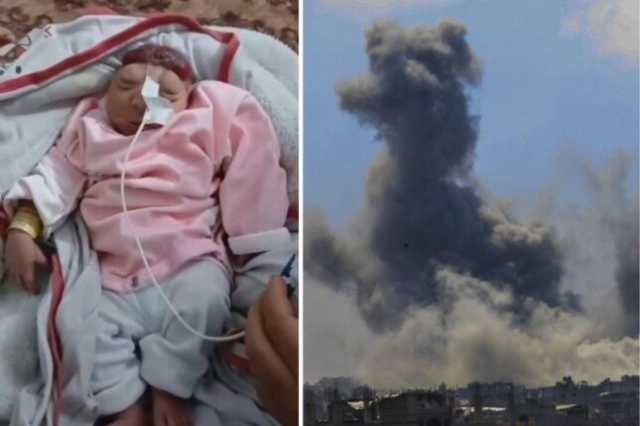 ولادة طفلة بلا دماغ مع تزايد ظاهرة 'تشوه الأجنة' في قطاع غزة