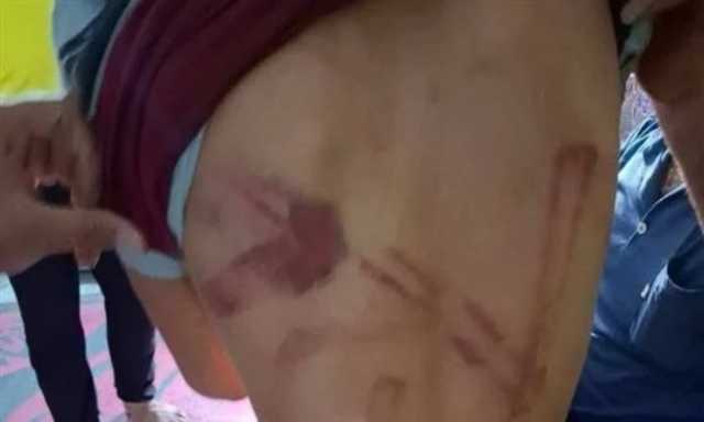 نام في منزل والدته بعد الطلاق.. التحقيق في تعدي أب بالضرب المبرح على طفله بالمنوفية