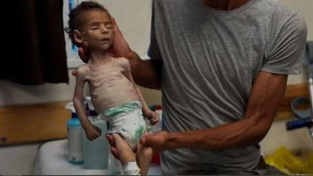 «التعاون الإسلامي» تطالب المجتمع الدولي بتحمل مسؤولياته بعد إعلان انتشار المجاعة في غزة