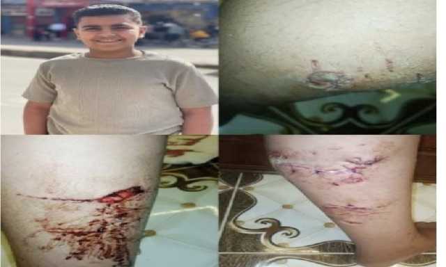 القبض على المتهم بالإعتداء على مصطاف بكلب شرس على شاطئ بورسعيد