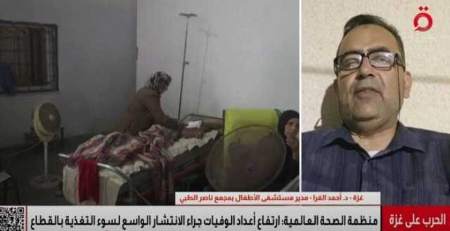 مدير مستشفى الأطفال بمجمع ناصر الطبي: كارثة سوء التغذية تحاصر أطفال غزة في ظل نقص الغذاء والدواء