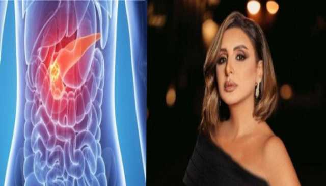 بعد استئصال أنغام جزء منه.. كيف يمكنك العناية بـ البنكرياس؟