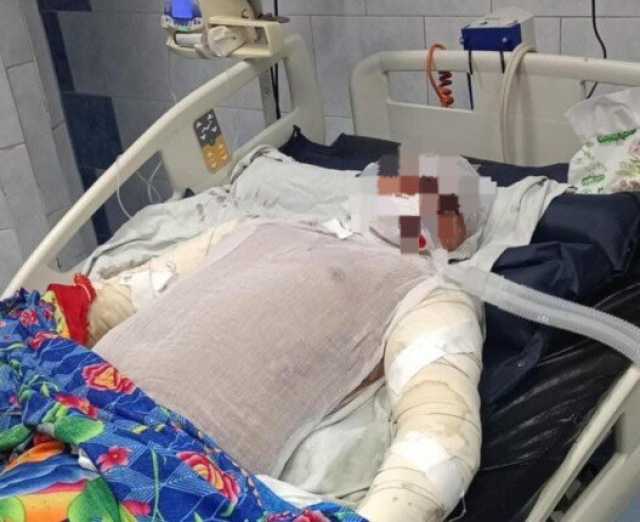 وداع مؤلم.. وفاة الشاب «أحمد جمال» ضحية حريق الباكيات بشبرا الخيمة