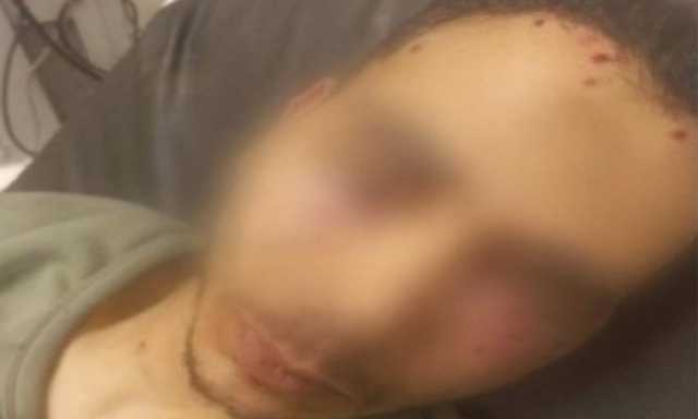 إصابة عامل برصاصة طائشة فى وجهه بمشاجرة بالأسلحة النارية بالقليوبية