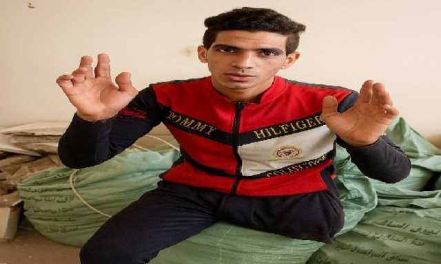 لم يستسلم للإعاقة.. عامل يومية يواصل كفاحه في الإسكندرية رغم فقدان ساقه