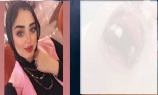 كسر في أسنانها.. ضبط زوج اعتدى بالضرب المبرح على طليقته في الشارع ببورسعيد