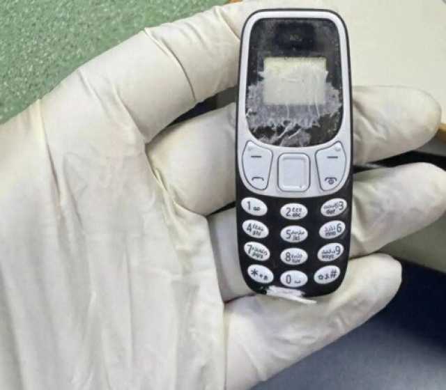 فريق طبي ينجح في استخراج هاتف محمول من بطن مريض ظل داخله 11 شهرا