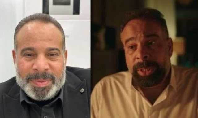 «دخل الرعاية المركزة».. تطورات الحالة الصحية للفنان أحمد الحلواني