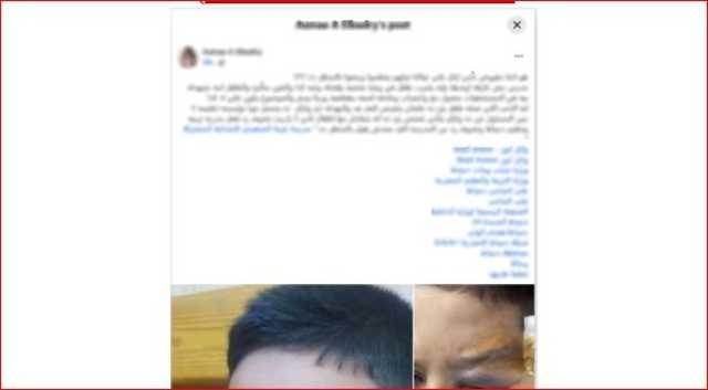 «ضربه دون قصد».. الداخلية تكشف ملابسات اعتداء مدرس على طالب في دمياط