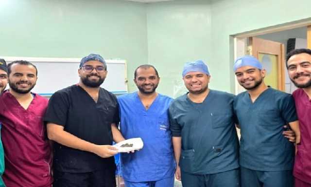 استخراج 58 حصوة من الكلية اليسرى لمريض في عملية دقيقة بمستشفى المعبر الجامعي