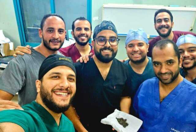 استخراج 58 حصوة من الكلية اليسرى لمريض أربعيني في عملية دقيقة بمستشفى المعبر الجامعي