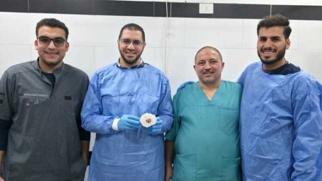 نجاح أول عملية لتقشير أورام الجهاز الهضمي بمستشفيات جامعة بني سويف