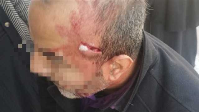 اعتداء على معلم داخل مدرسة بالإسماعيلية.. والمتهم ينتحل صفة ولي أمر