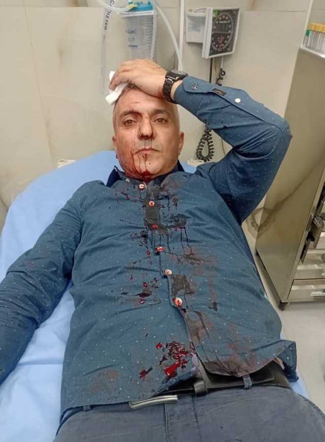 الزميل فارس الحباشنة يتعرض لاعتداء أمام منزله في عمّان