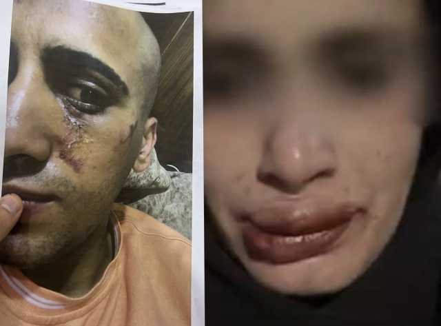 عاجل | أحمد يخرج عن صمته ويكشف تفاصيل تعذيبه هو وشقيقه على يد والده وإخوته .. فيديو وصور