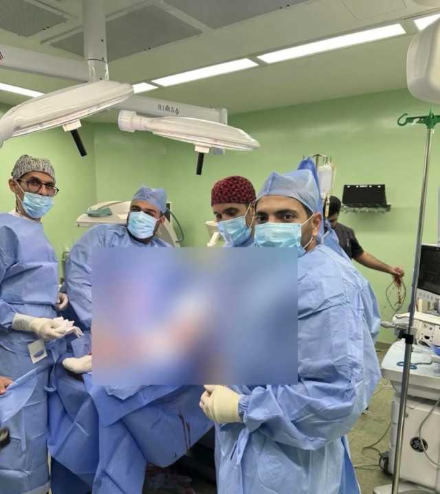 إنقاذ ذراع طفلة بعد بترها في عملية نادرة بمستشفيات البشير