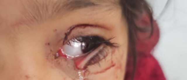 المحامي العجوري يسأل عن سلطة جمعية الرفق في الحيوان