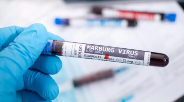 ظهور فيروس ماربورغ القاتل في إثيوبيا .. منظمة الصحة العالمية تعلن حالة استنفار