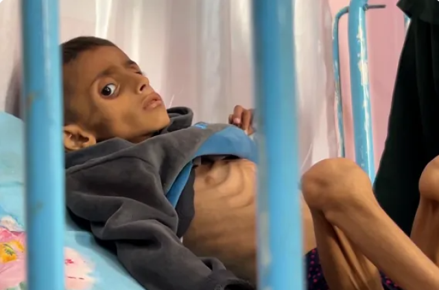 الجحيم .. هذا ما يواجهه أطفال غزة