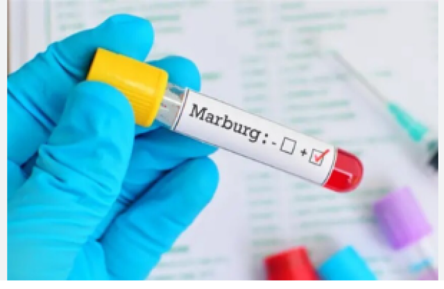 بعد انتشار الشائعات .. وزارة الصحة تؤكد: فيروس ماربورغ لا يهدد مصر