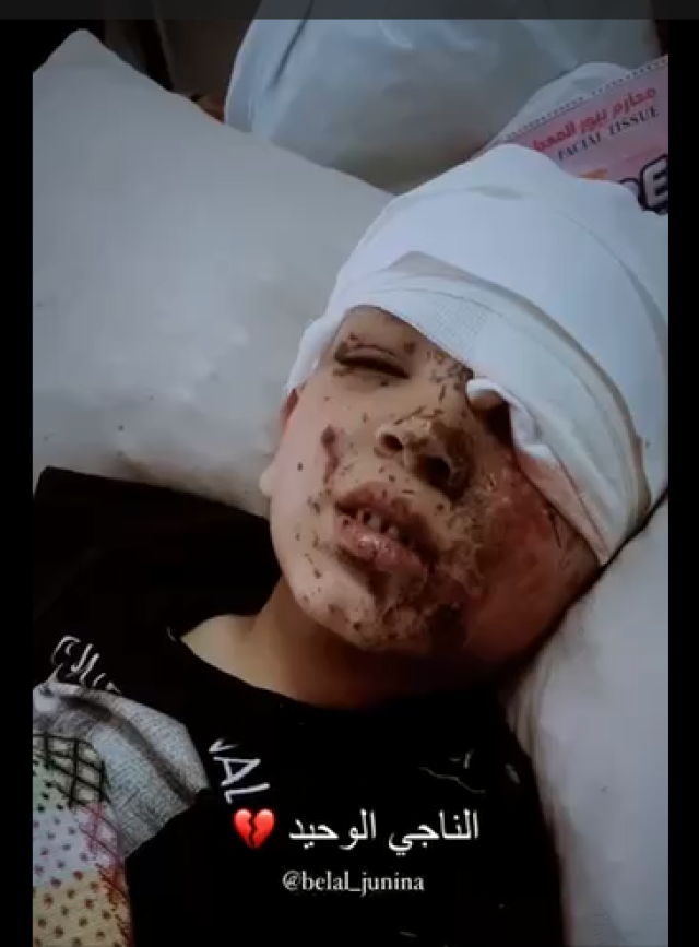 الناجي الوحيد طفل أصيب واستشهدت عائلته بعد قصف منزلهم في غزة - فيديو
