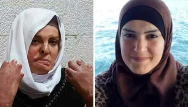 أحرقها الاحتلال.. من هي الأسيرة الفلسطينية المحررة إسراء جعابيص