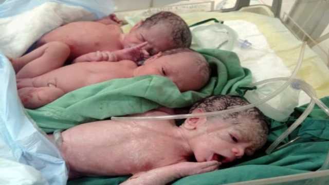 شاهد .. ولادة 3 توائم في مستشفى الكويت بصنعاء
