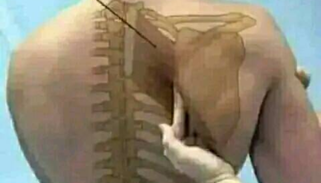 أسباب مرض الأبهر الوثاب